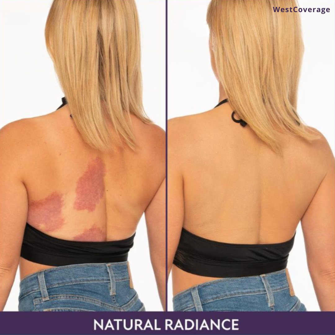 WestCoverage - Body Coverage Perfector